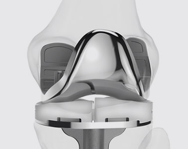 Orthopedic prostheses in guadalajara
